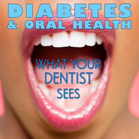 Dental and Diabetes