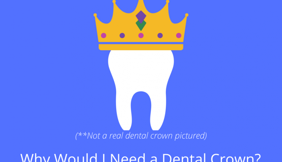 A Dental Crown blog image