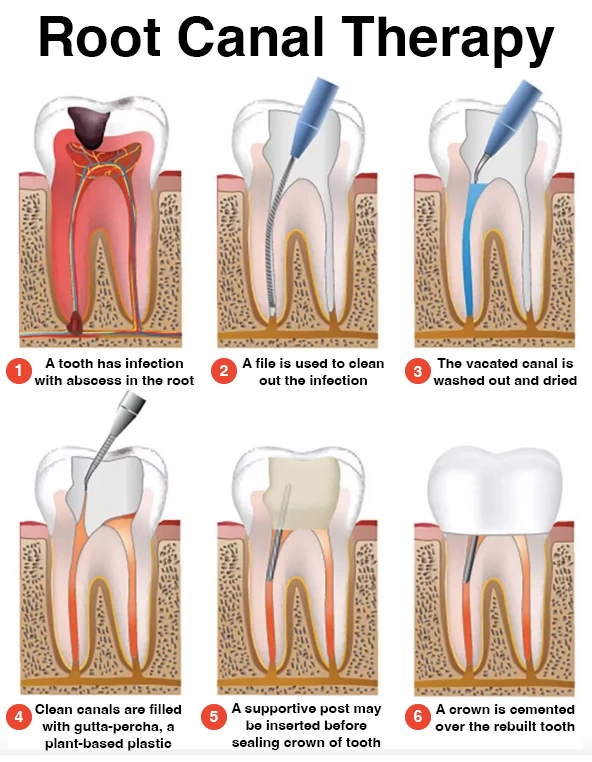 9 Popular Teeth Whitening Myths That Are Just Plain Wrong - My