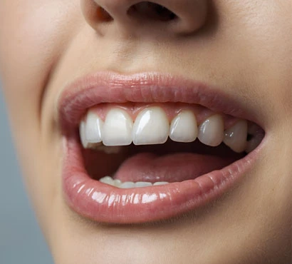 White teeth look fresher, younger, and healthier.